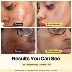 Jumbo Vitamin C Clay Mask